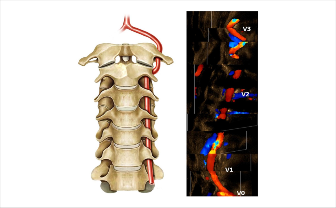 Eco doppler vertebras