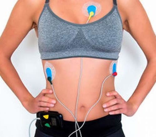 Holter 24 horas