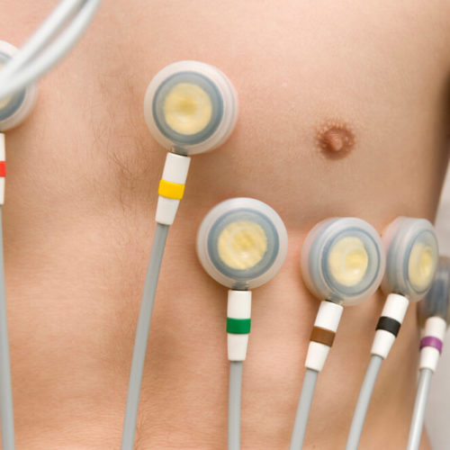 Eletrocardiograma (ecg)