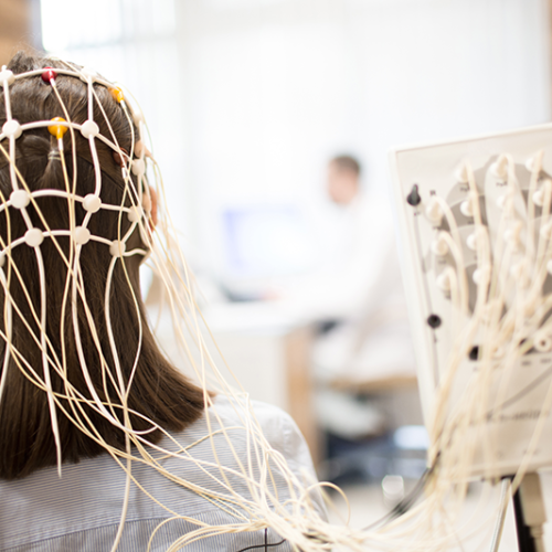 Eletroencefalograma (eeg)